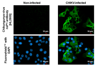 Anti-Chikungunya virus nsP1 antibody [HL2605] used in Immunocytochemistry/ Immunofluorescence (ICC/IF). GTX639057